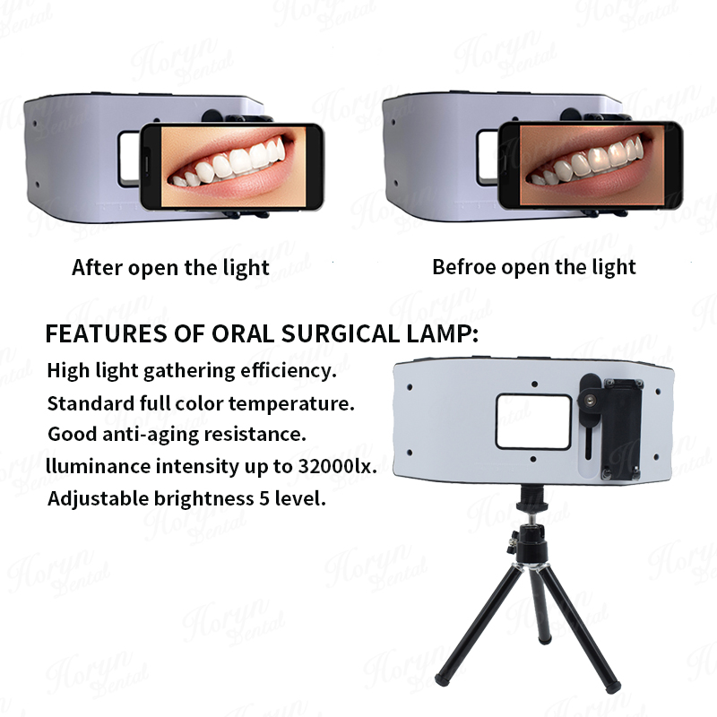 Luz de flash dental equipament - Photography Equipment avaliação e preço